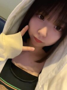 ウミ